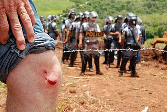  	Trabalhador rural mostra ferimento por bala de borracha em seu joelho (Foto: João Zinclar 15/12/09)